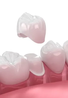crowns