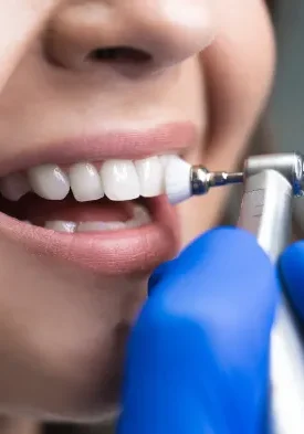 teeth-cleaning