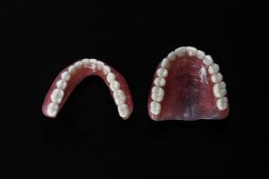 upper dentures typically cover the upper palette while the lower denture rests on the gum ridge