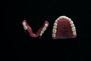 partial dentures can replace several teeth when there are others remaining
